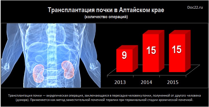 Doc22.ru Трансплантация почки в Алтайском крае  (количество операций 2013-2015 гг)